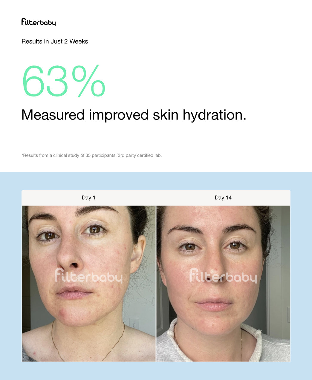 Skincare Faucet Filter 2.0
