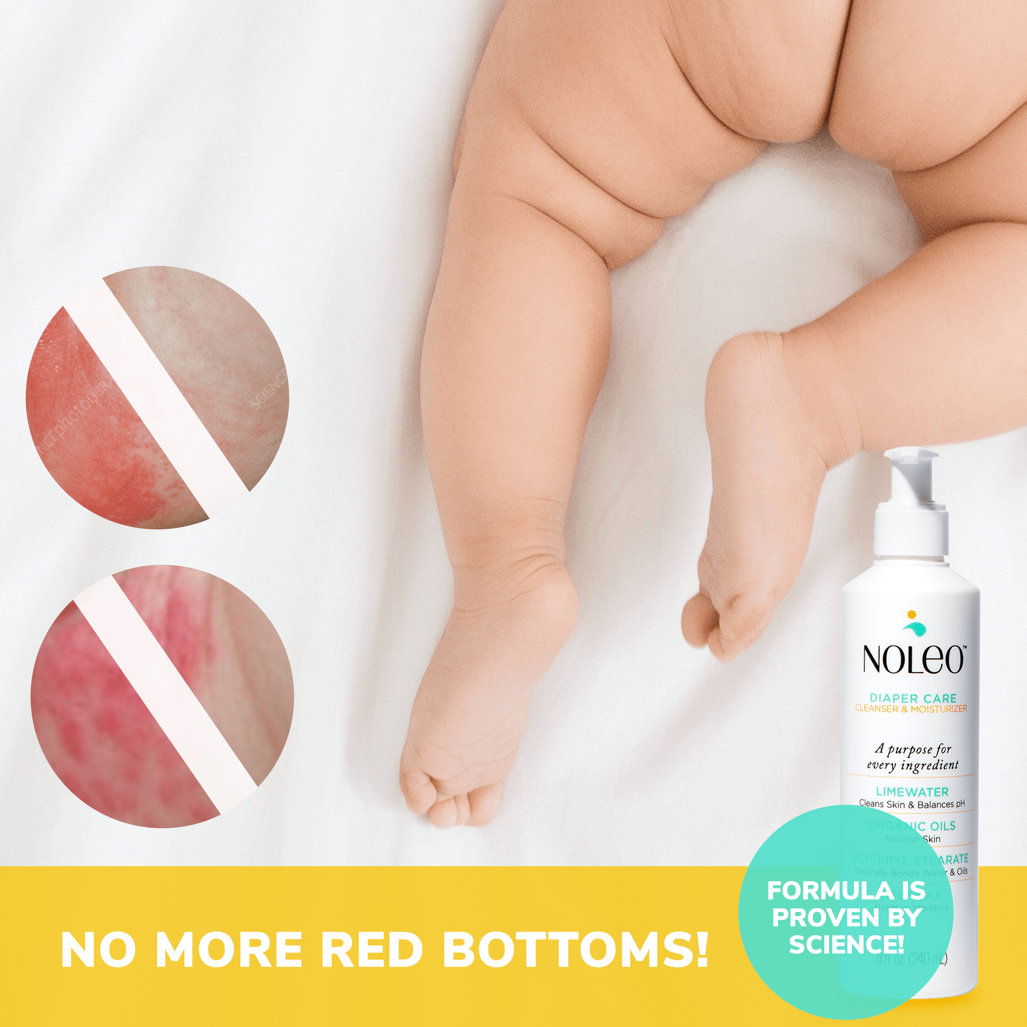 Diaper Rash Cream & Large Cotton Pads